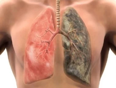 Τι θα συμβεί αφότου κόψετε το τσιγάρο - Πόσο θα χρειαστεί να «καθαρίσουν» οι πνεύμονες